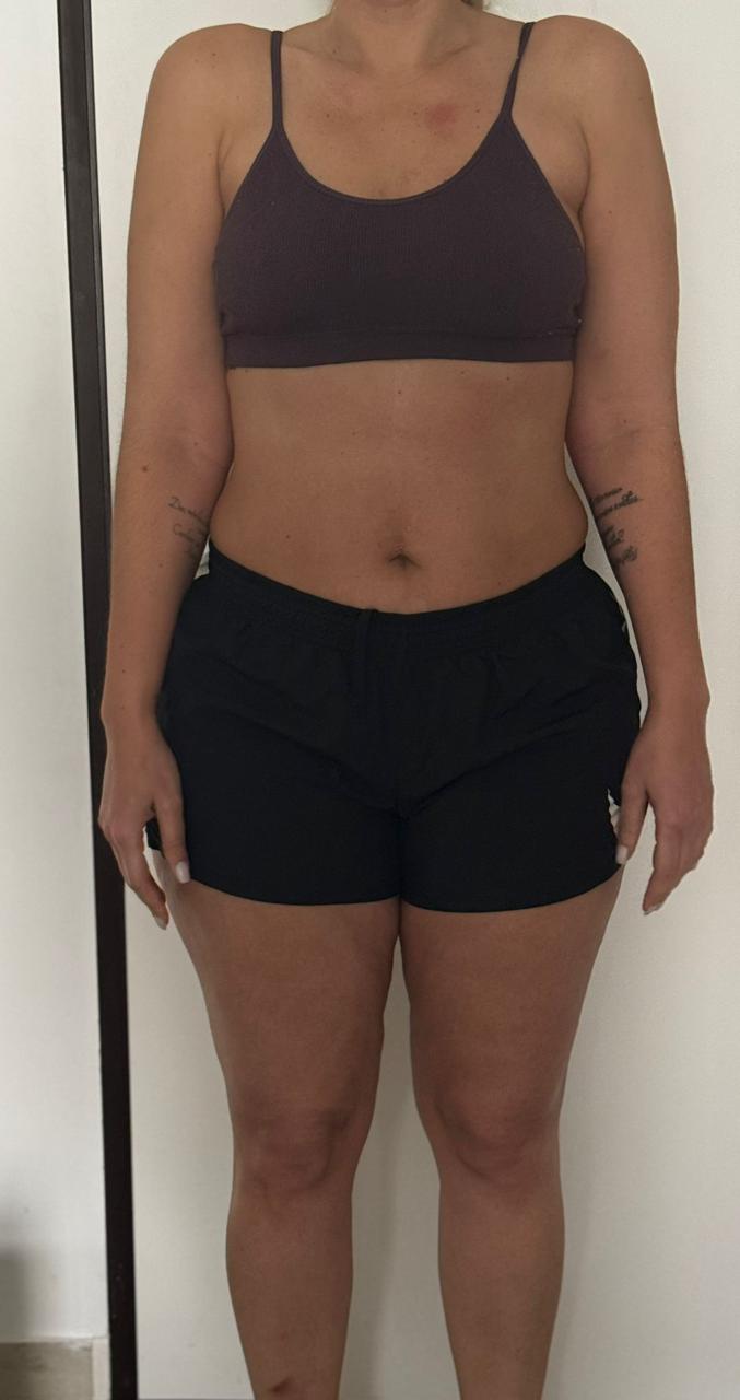 Antes - costas
