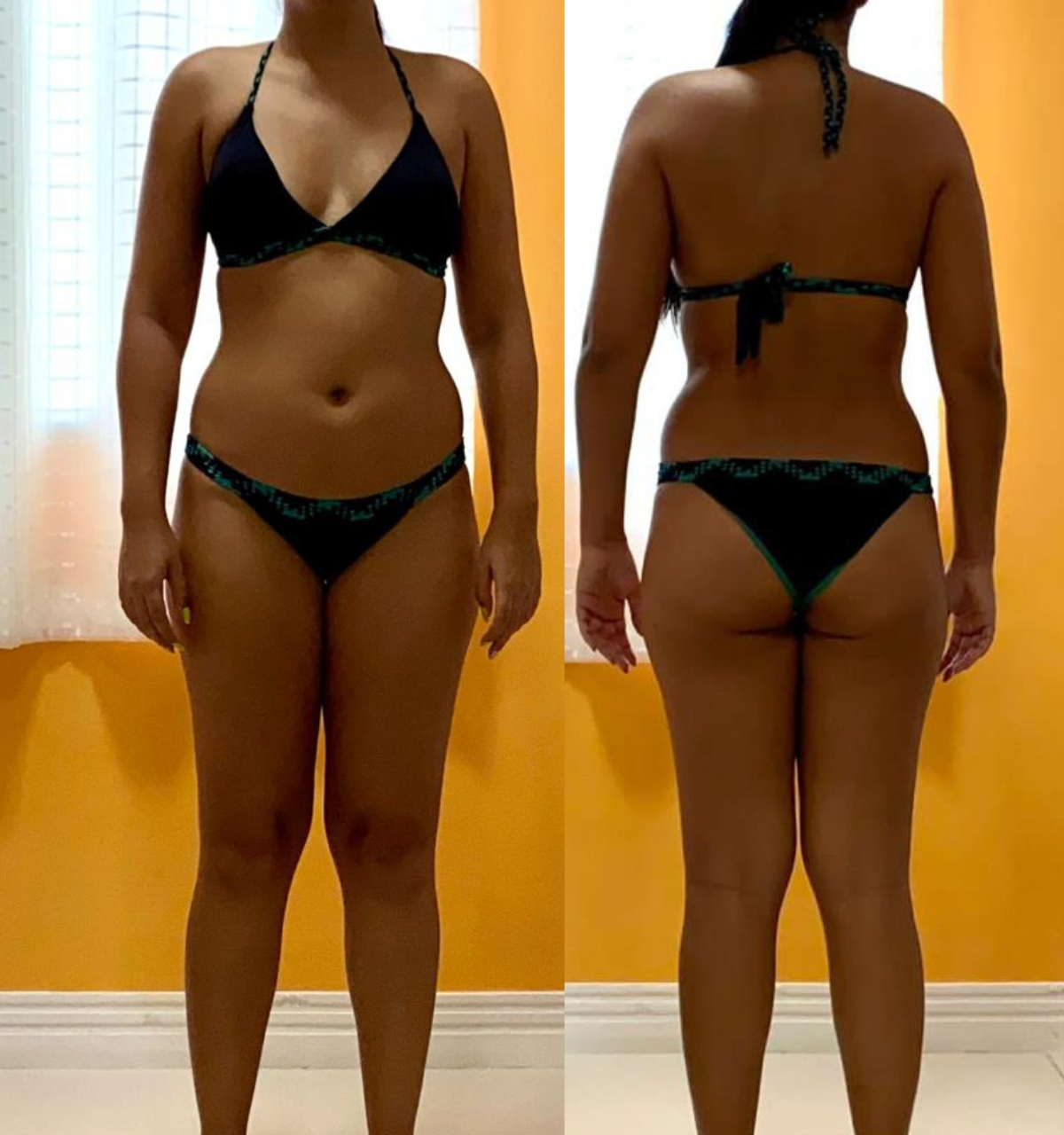 Antes - costas